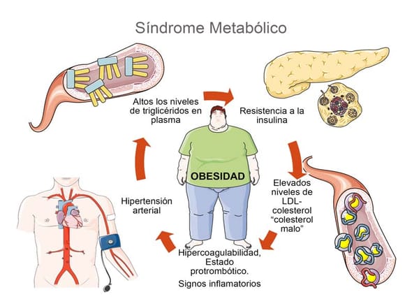 Síndrome metabólico: Cómo combatirlo y vivir una vida saludable